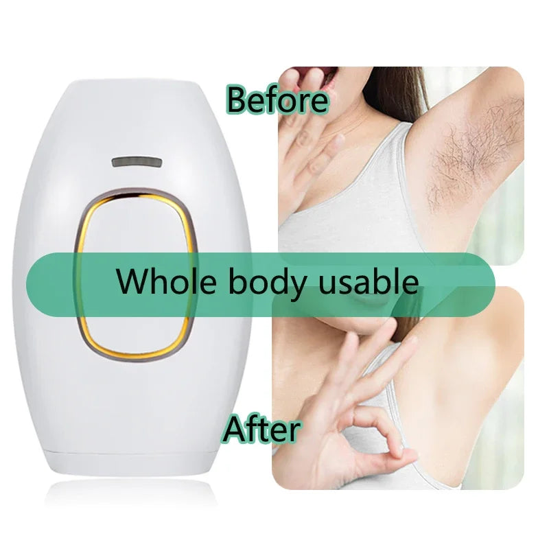 Depiladora Láser FASTYLE IPL – 999,999 Flashes • Suavidad Permanente • 5 Niveles Sin Dolor – Para Cuerpo, Axilas, Bikini y Rostro